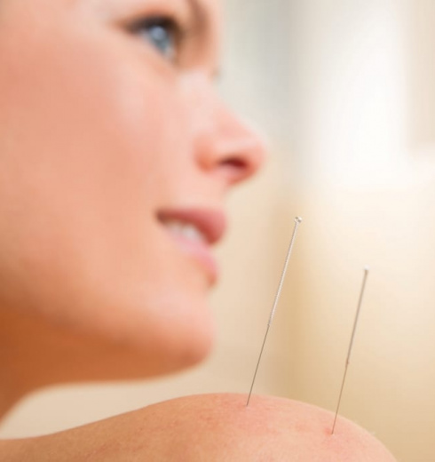 Bnh Acupuncture 845x684