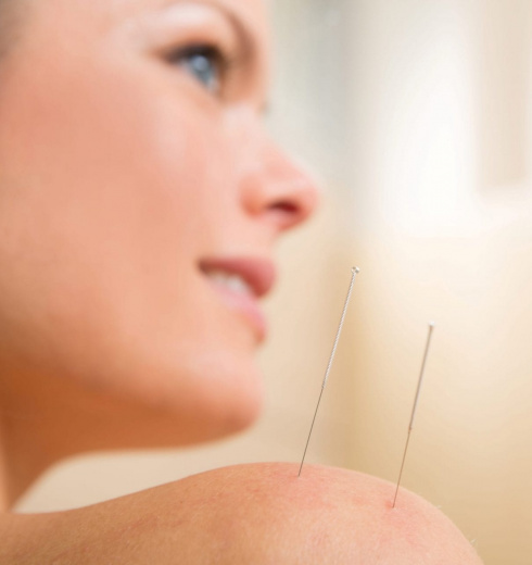 Bnh Acupuncture