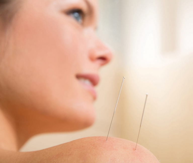 Bnh Acupuncture