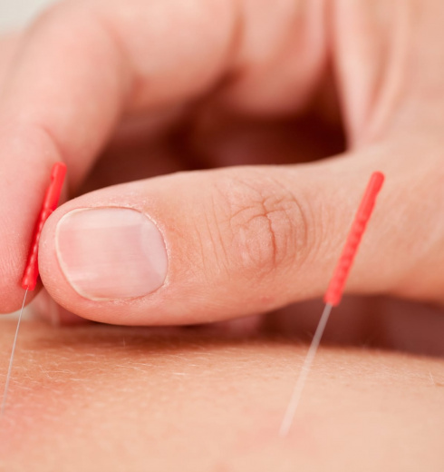 Acupuncture Macro