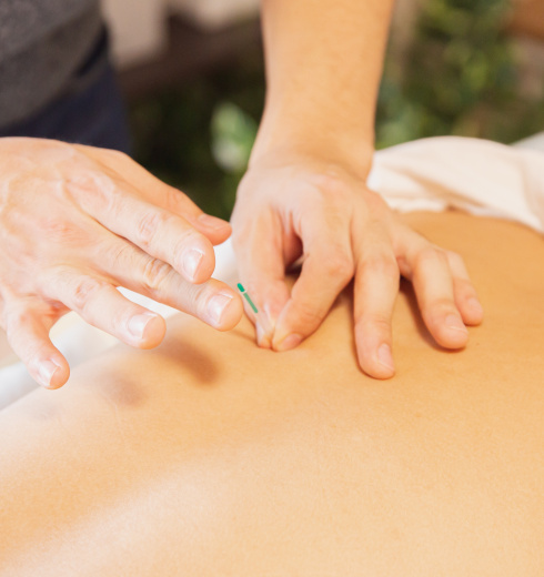 Shift_Acupuncture