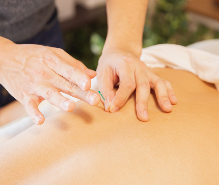 Shift_Acupuncture